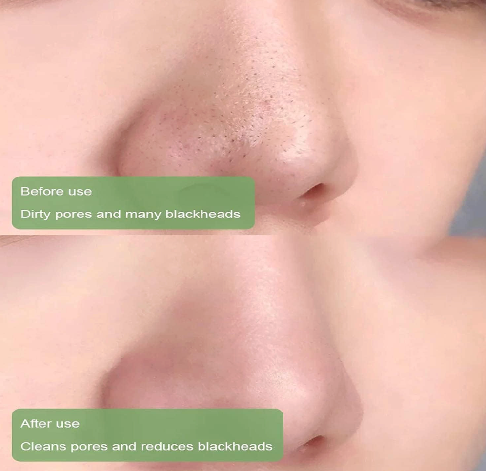 Stick Clay Mask